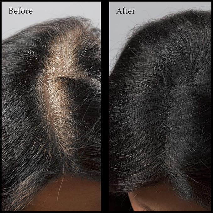 Hair Root Touch Up Powder - Black - Root Cover Up & Hairline Concealer - Longer-Lasting Power - 11 True-to-Nature Shades - Zero Fragrance, Talc or Parabens - With Brush