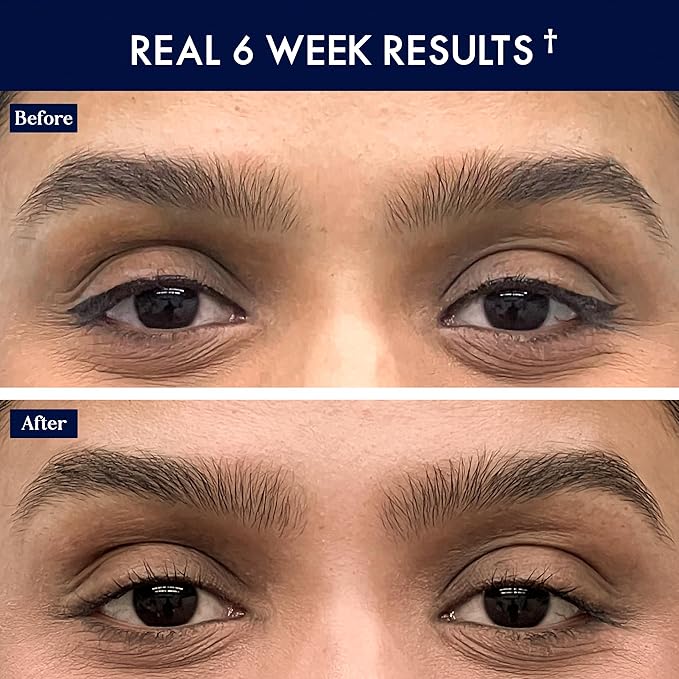 SugarbearPRO LashCare™ + BrowCare™ Vitamin Serum Duo | Peptides, MSM & Biotin | 3-Month Supply Each | Vegan Formula for Fuller, Healthier-Looking Lashes & Brows