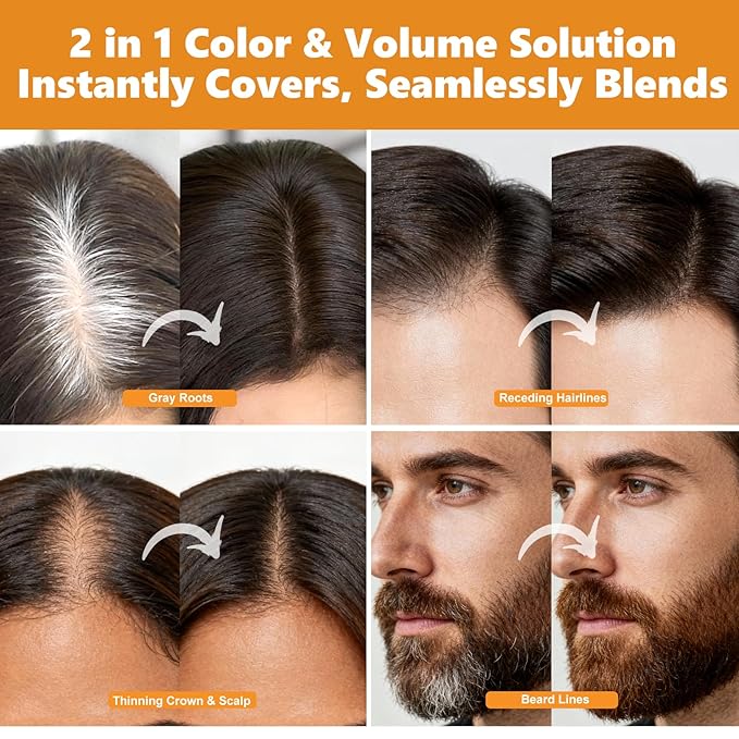 Root Touch Up Hair Color Spray–4oz, Sweat-Resistant & Natural, Instant Gray Hair Cover Up, Temporary Root Concealer Hair Filler Dye Spray for Hairline, Scalp&Thinning– Medium Brown–Women & Men