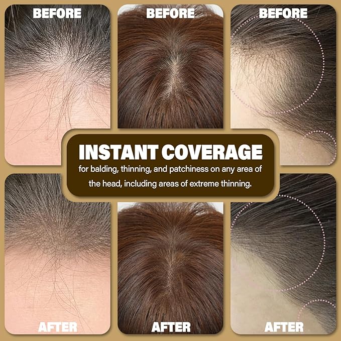 Root Touch Up Hair Color Powder For Concealing Hair Loss and Thinning, Gray Hair Shadow Powder Root Cover Up Hairline Powder For Women Men Eyebrows, Beard Line (Blonde, 0.35Ounce)