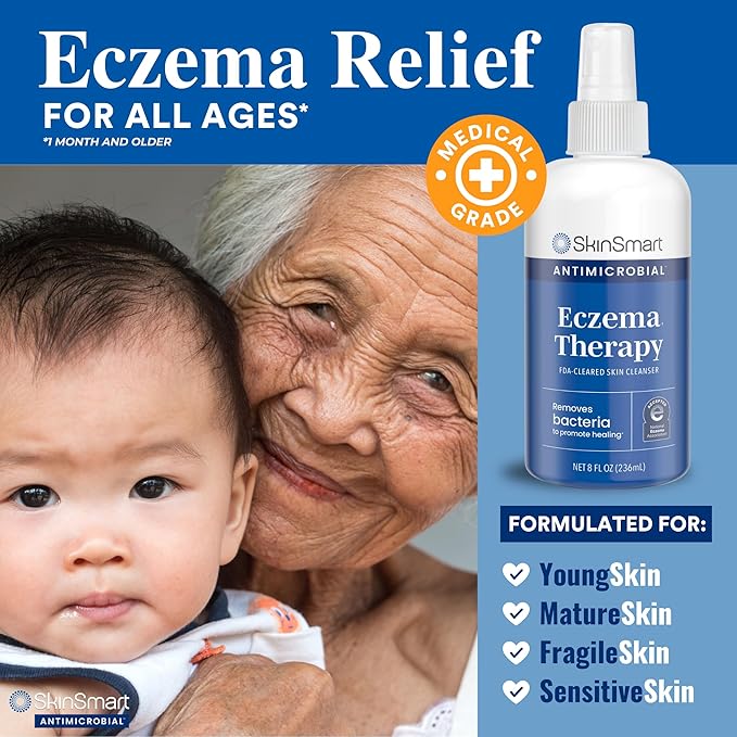 SkinSmart Antimicrobial Eczema Therapy with Hypochlorous Acid, Safely Removes Bacteria so Skin Can Heal, for Adults, Kids and Seniors, 8 Ounce Clear Spray