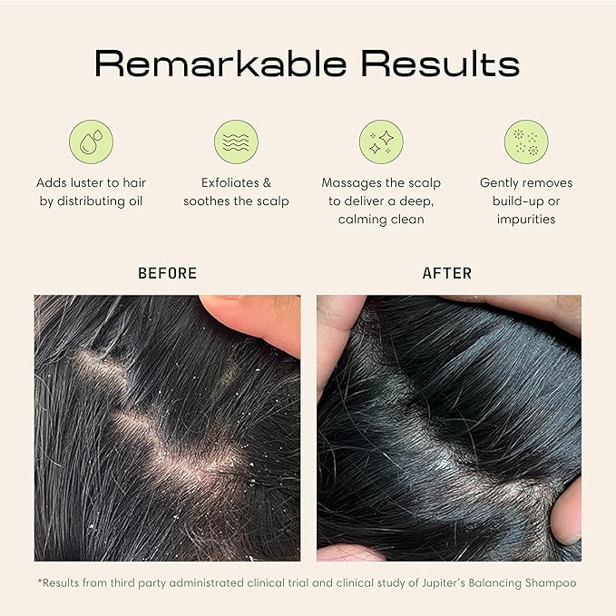 Jupiter Scalp Exfoliator - Scalp Massager Tool for Wet & Dry Hair - Ergonomic Detangler Brush - Dandruff Comb & Scrub to Remove Dandruff & Buildup and Support Circulation - Black/White