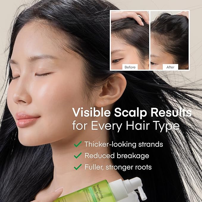 Scalp Serum for Hair Growth Spray – Korean Vegan Treatment for Hair Loss, Thinning & Itchy Scalp, Non-Greasy, Lightweight Formula to Exfoliate Dandruff & Strengthen Roots – For Men & Women (100 mL)