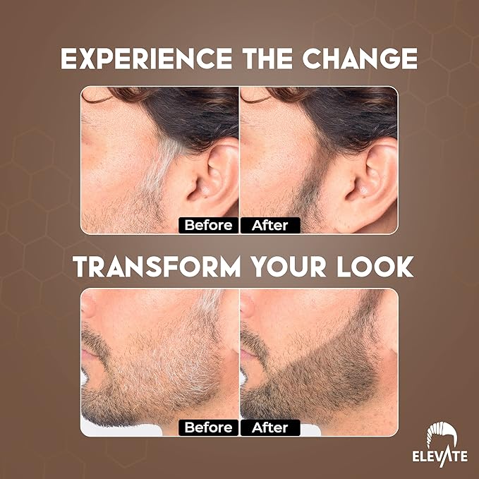 ELEVATE Hair Line Powder Instantly Conceal Hair Loss for Thinning Areas - Shadow Makeup - Root Cover Touch Up with Puff Touch - Instant Gray Coverage for Men and Women (Dark Brown)