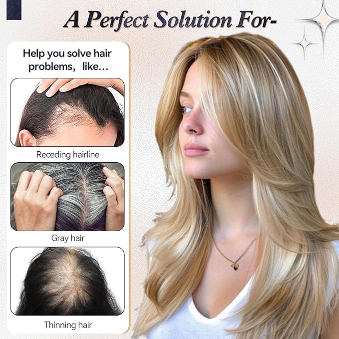 starluck Human Hair Topper for Women with Thinning Hair, 100% Real Human Hairpiece, 4.6 * 4 Inch Upgrade SilkHug Swiss Lace Base Hairpiece,14 Inch, No Bangs (Ombre Ash Blonde)