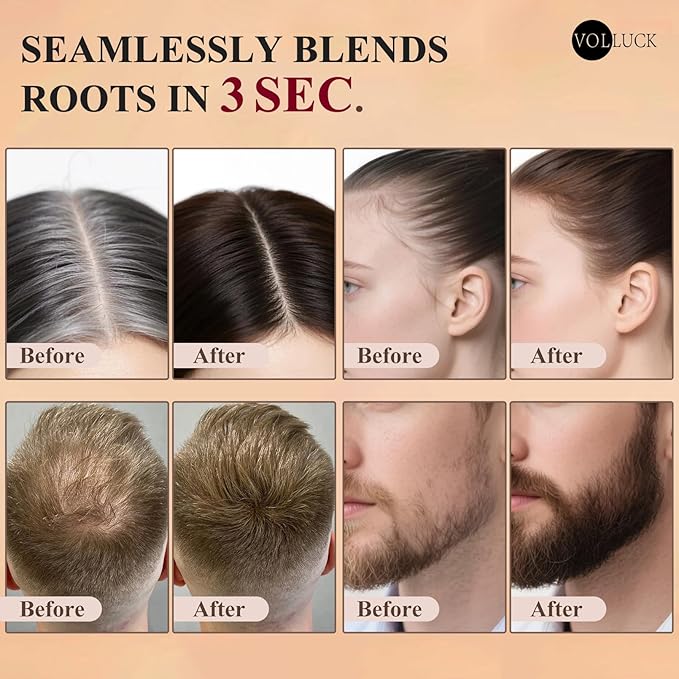 VOLLUCK Hairline Powder Instantly, Root Touch up Powder Hair Color Upgraded, Grey Root Cover up Conceals Hair Loss, Hairline Shadow for Women & Men for Thinning Hair Natural, Sweatproof (Black)