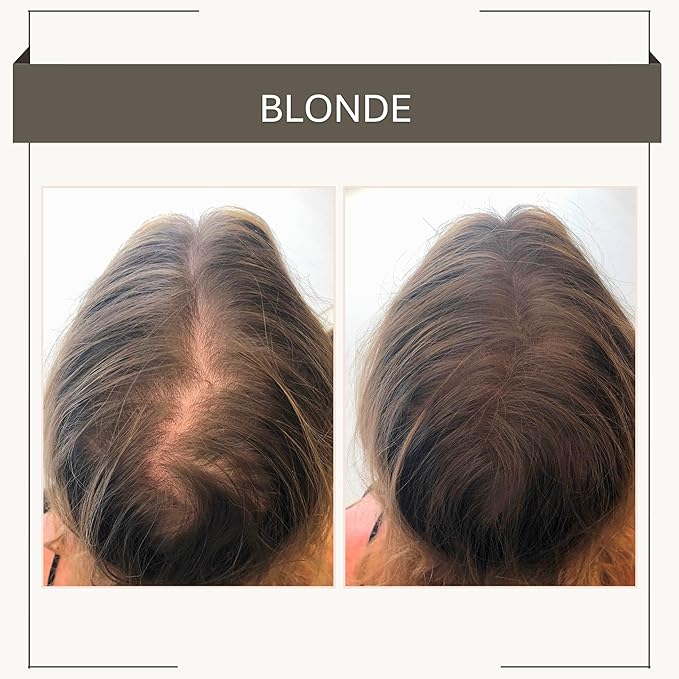Joan Rivers Great Hair Day Root Touch Up Powder Duo - Fill-in Powder for Thicker, Fuller Looking Hair (Blonde)