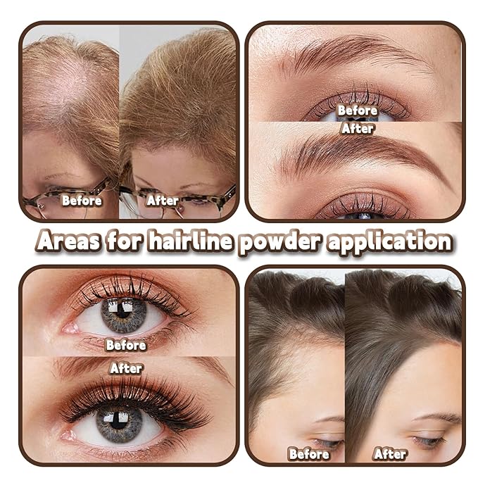 Root Touch Up Powder Hair Color Dark Brown, Root Cover Up Hair Powder for Women Scalp Concealer, HairlinePowder for Women GrayHair