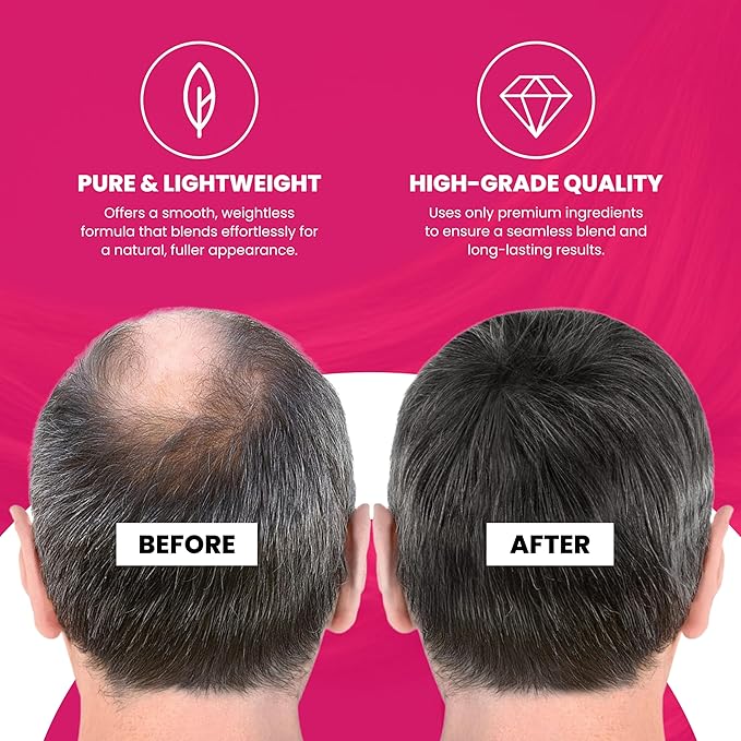 VELO Hairline Powder–AUBURN Hair Root Touch Up Powder for Women & Men–Instantly Covers Gray Hair, Thinning Hair & Bald Spots–Sweatproof Root Cover Up–Puff & Mirror Compact, 13 Shades