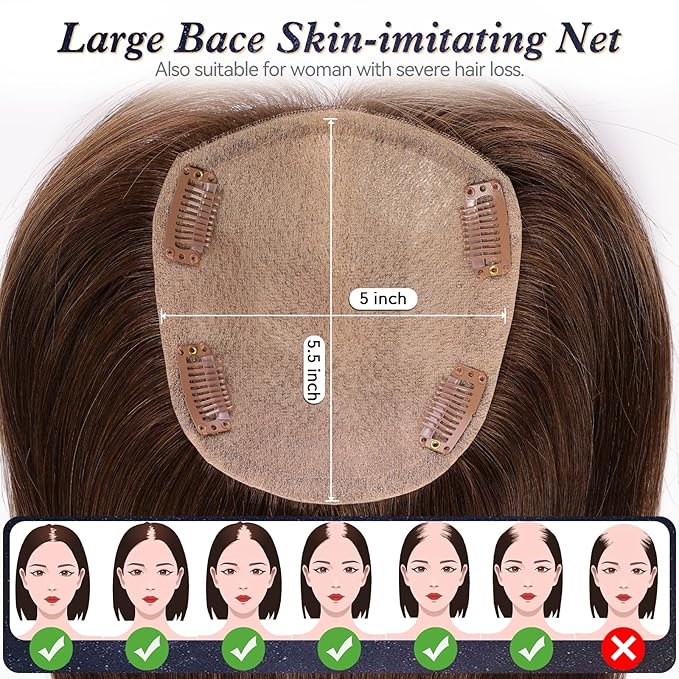 starluck Hair Toppers for Women Real Human Hair, 5"*5.5"Large Coverage Ombre Ash Blonde HairTopper No Bangs,100% Real Human Hair Toppers for Women with ThinningHair,Cover Gray Hair Roots