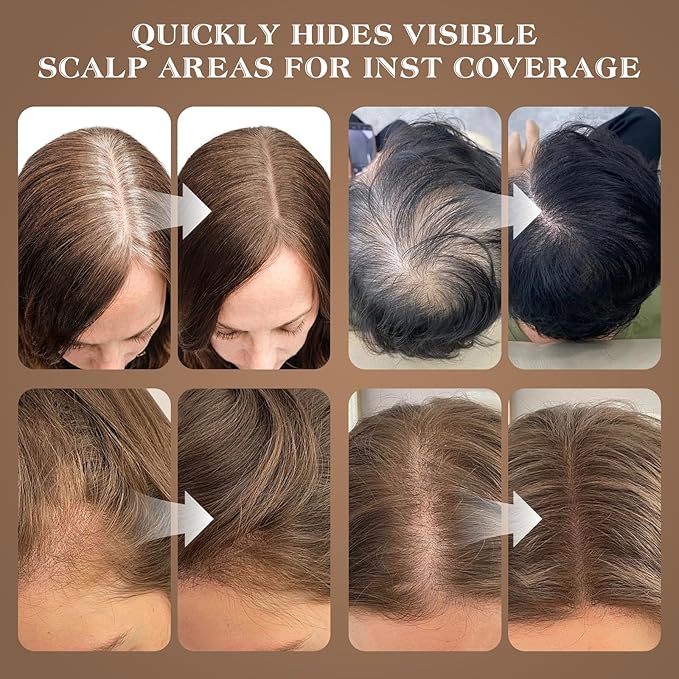 Hairline Shadow Powder, Dark Brown, Root Touch Up Powder for Instantly Gray Hair Cover Up, Women Color Root Coverage for Thinning Grey, Mens Roots Concealer for Hair Loss Beard Line, #3