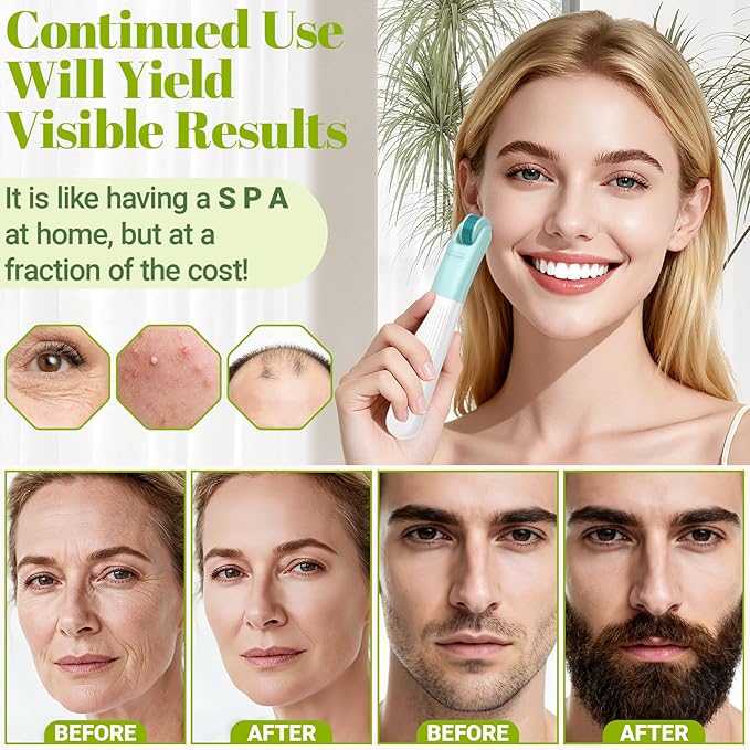 Derma Roller, TUMAKOU 10 in 1 Microneedle Roller Set for Face, Body, Scalp, Beard Hair, Microneedling Micro Needling Roller Kit for Women Men, with Storage Case & Face Ice Roller & Facial Brush(Green)