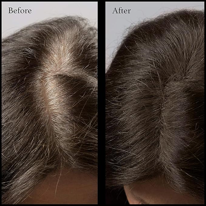 Hair Root Touch Up Powder - Darkest Brown - 11 True-to-Nature Root Concealer Shades - Longer-Lasting, Easy Hairline Shading with Clean Ingredients - With Brush