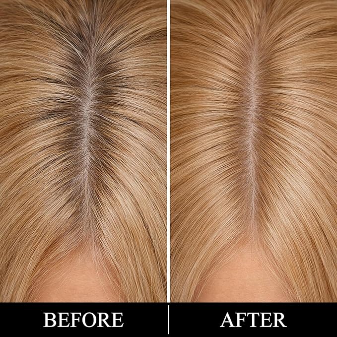 Root Touch Up Hair Color – 3 Color Blendable Hairline Powder for Gray Coverage, Root Cover Up & Thinning Edges – 48H Sweat Resistant, Natural Finish for Women & Men – Brown