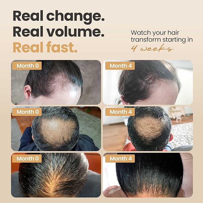 Vitasei Hair Booster 2 Fl Oz (3 Pack) – Hair Revitalizing Serum with Capilia Longa, Wild Olive Stem Cells & Arginine – Peptide-Enriched Hair Tonic Supports Thicker, Stronger Hair – For Women & Men