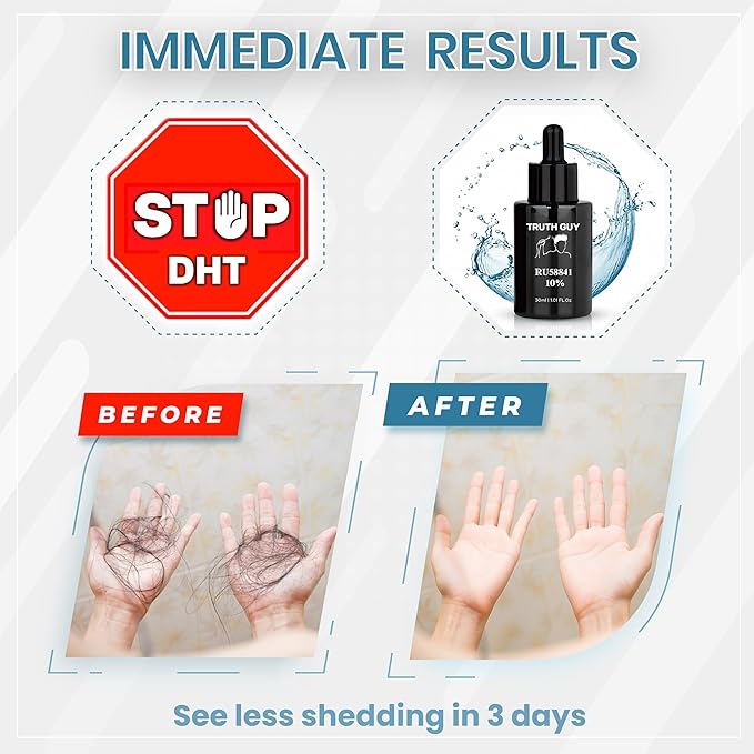 Truth Guy RU58841 10% Hair Serum for Men – Powerful DHT Blocker with Maximum Strength – Targets Male Pattern Thinning and Receding Hairline – Promotes Fuller, Healthier-Looking, Stronger Hair – 30 ml