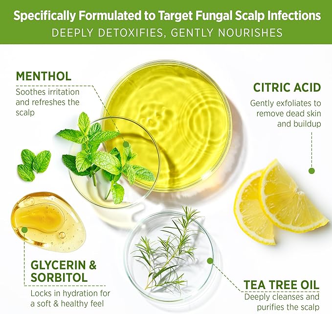 Roycederm Tea Tree Scalp Scrub with Scalp Massager Brush – Deep Cleansing & Exfoliating Pre-Shampoo Treatment for Dry, Flaky Scalp – Gently Refreshes, Hydrates & Balances Scalp