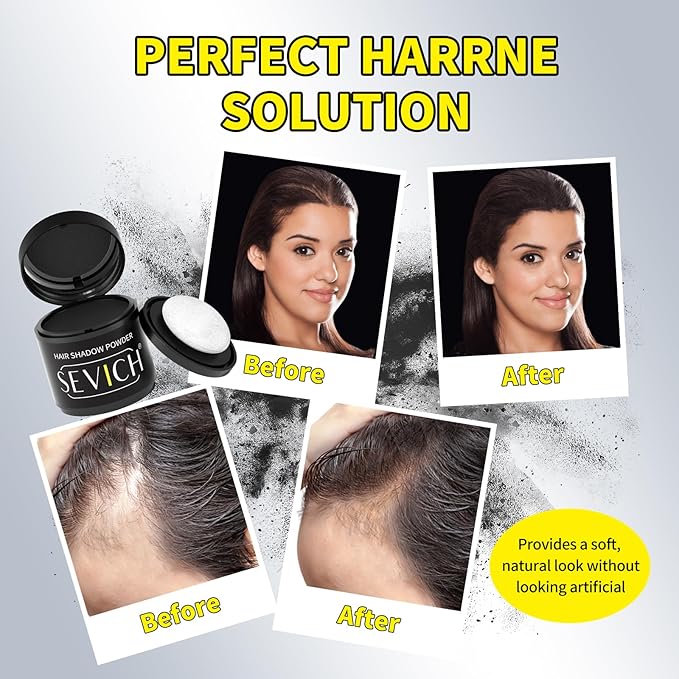 Sevich Hairline Powder 10g 2-Pack with Brush, Instantly Conceals Hair Loss & Thinning, 48H Waterproof Root Touch Up Powder, Natural Hair Shadow Toppers for Women & Men, 2 Box = 5 Boxes,Brown