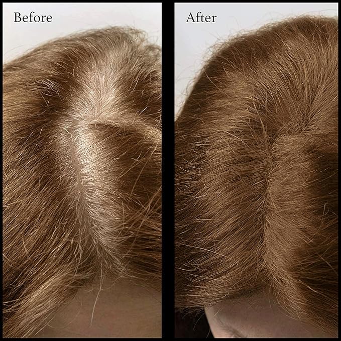 Root Touch Up Powder - Natural Hairline Concealer with 11 Shades - Free of Fragrance, Talc & Parabens (With Brush, Warm Brown)