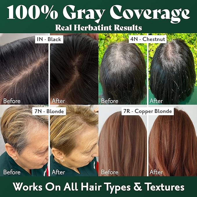 Herbatint Permanent Hair Dye - 10N Platinum Blonde - For Up To 100% Gray Coverage of Resistant Gray Hair - Ammonia-Free, Alcohol-Free & Vegan - Salon Influenced Hair Color 5.75 fl oz (Pack of 4)
