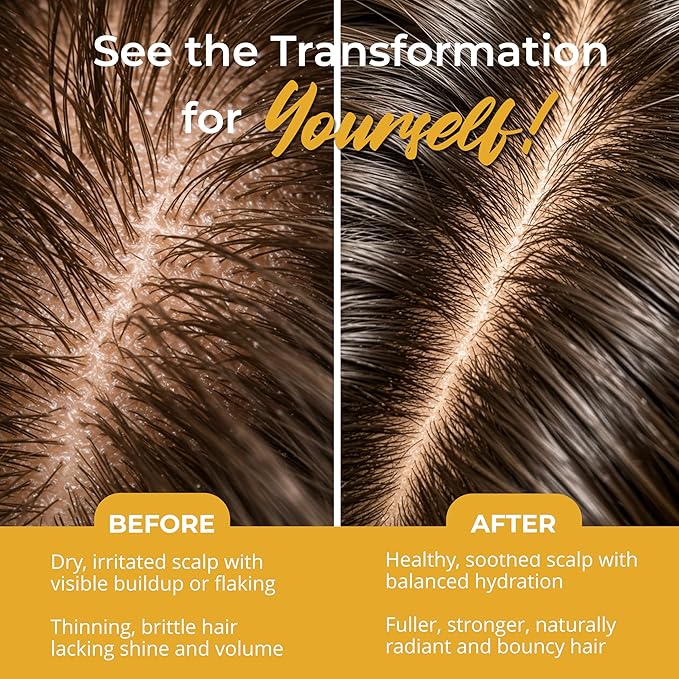 Dry Scalp Treatment for Women – 3-Step Scalp & Follicle Care System – Argan Oil Blend Hair Treatment, Herbal Cleansing Shampoo & Nutrient Rich Rinse – Soothes Itch, Reduces Flakes, Sulfate-Free