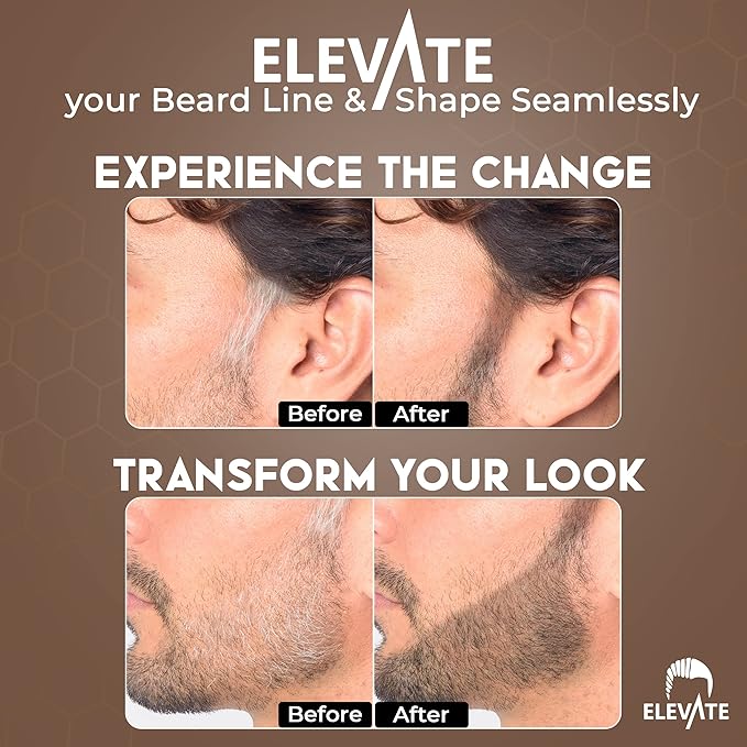 ELEVATE Hair Line Powder Instantly Conceal Hair Loss for Thinning Areas - Shadow Makeup - Root Cover Touch Up with Puff Touch - Instant Gray Coverage for Men and Women (Medium Brown)